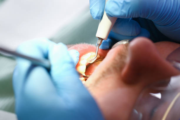 Best Emergency Cosmetic Dentistry in Wimberley, TX